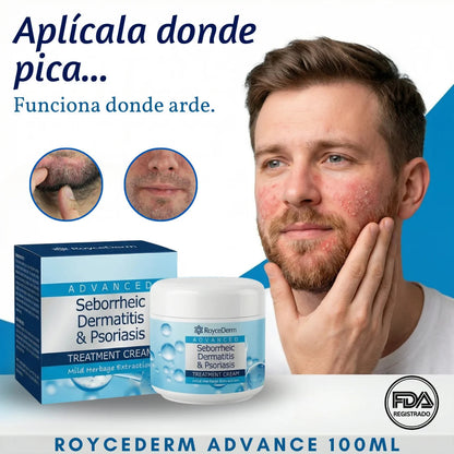 Crema RoyceDerm® - Alivia La Dermatitis En Minutos